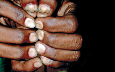 سيرة الأظافر